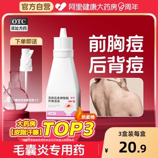 丽芙克林霉素磷酸酯外用溶液喷雾克林霉素磷酸溶液喷雾背部祛痘